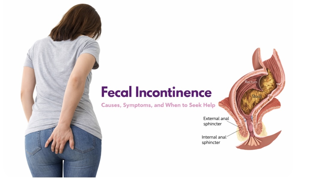 Rectal Prolapse and Fecal incontinence treatment